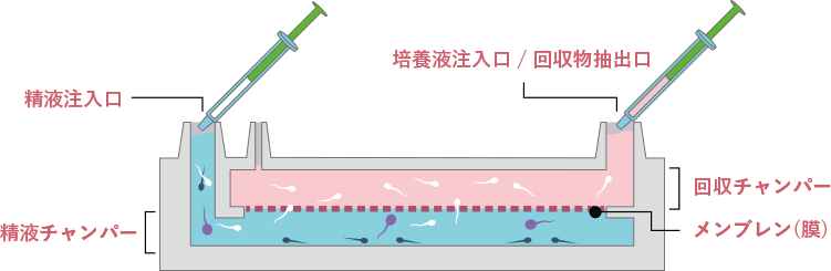 精子回収方法