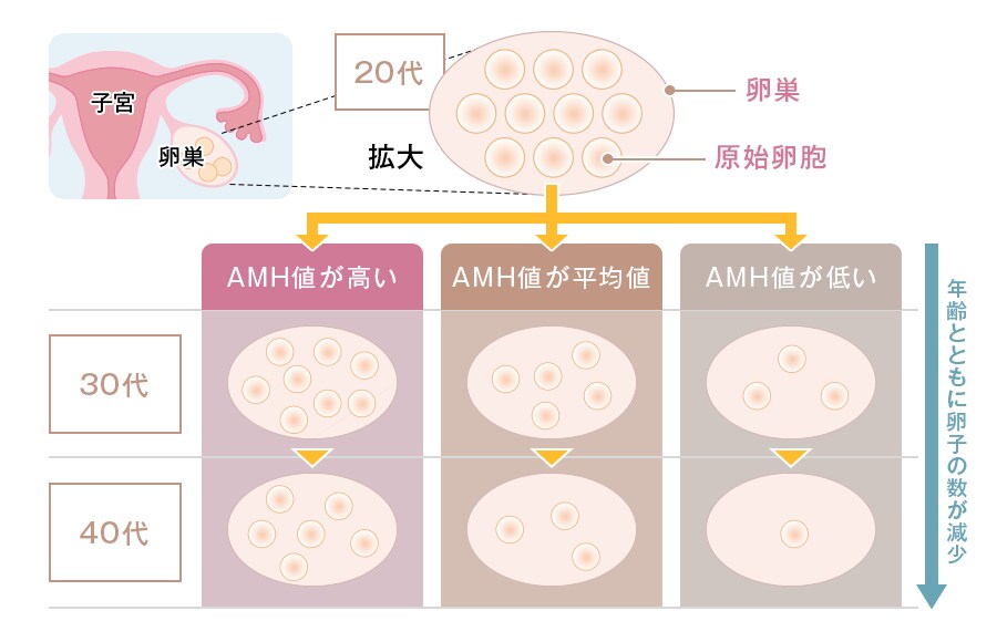 抗ミュラー管ホルモン（AMH）