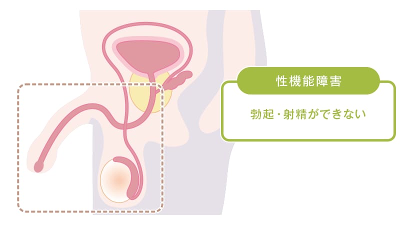 男性不妊の原因