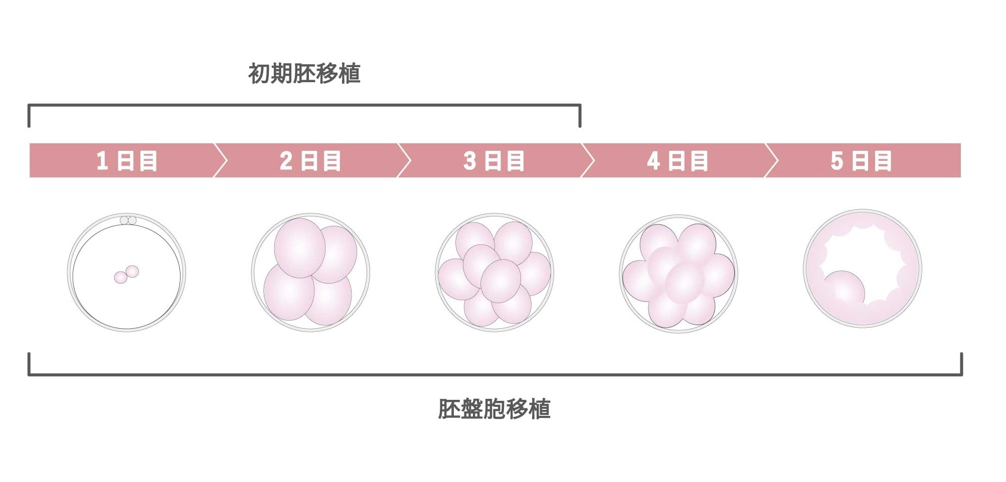 胚移植