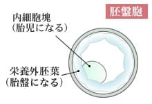 胚盤胞