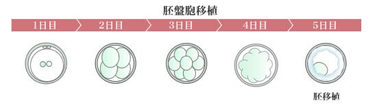 胚盤胞移植