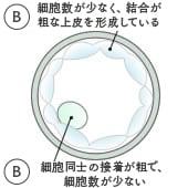 3BB