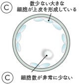 3CC