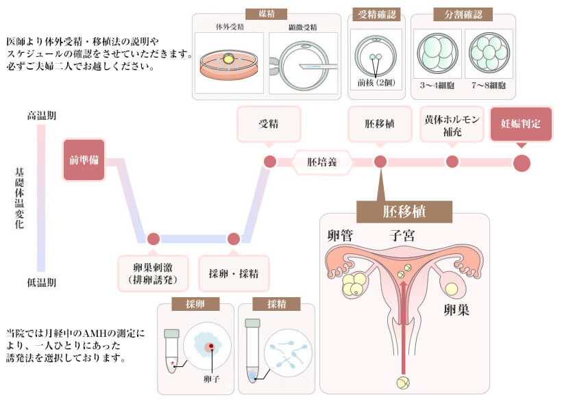 体外受精・胚移植法のスケジュール