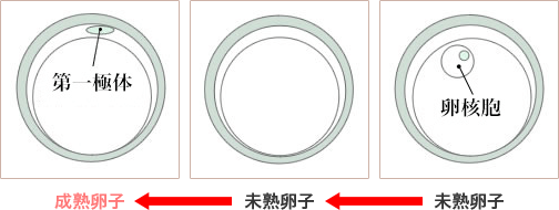 成熟卵子←未熟卵子←未熟卵子