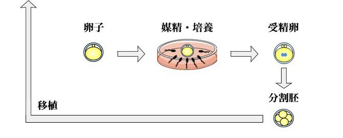 Aさんの場合