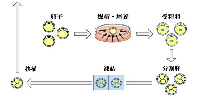 Bさんの場合