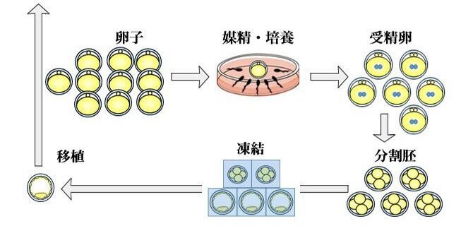 Cさんの場合