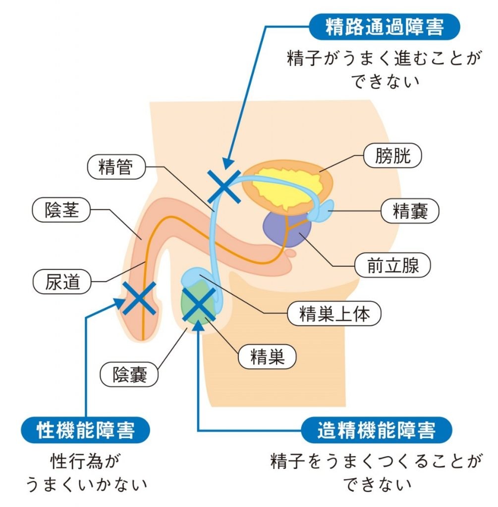 精液 精液の色ってどんな色？ ～黄、緑、ピンク、赤、茶色、オレンジ ...