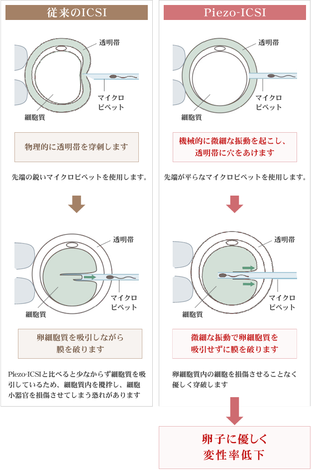 Piezo-ICSIと従来のICSIの比較